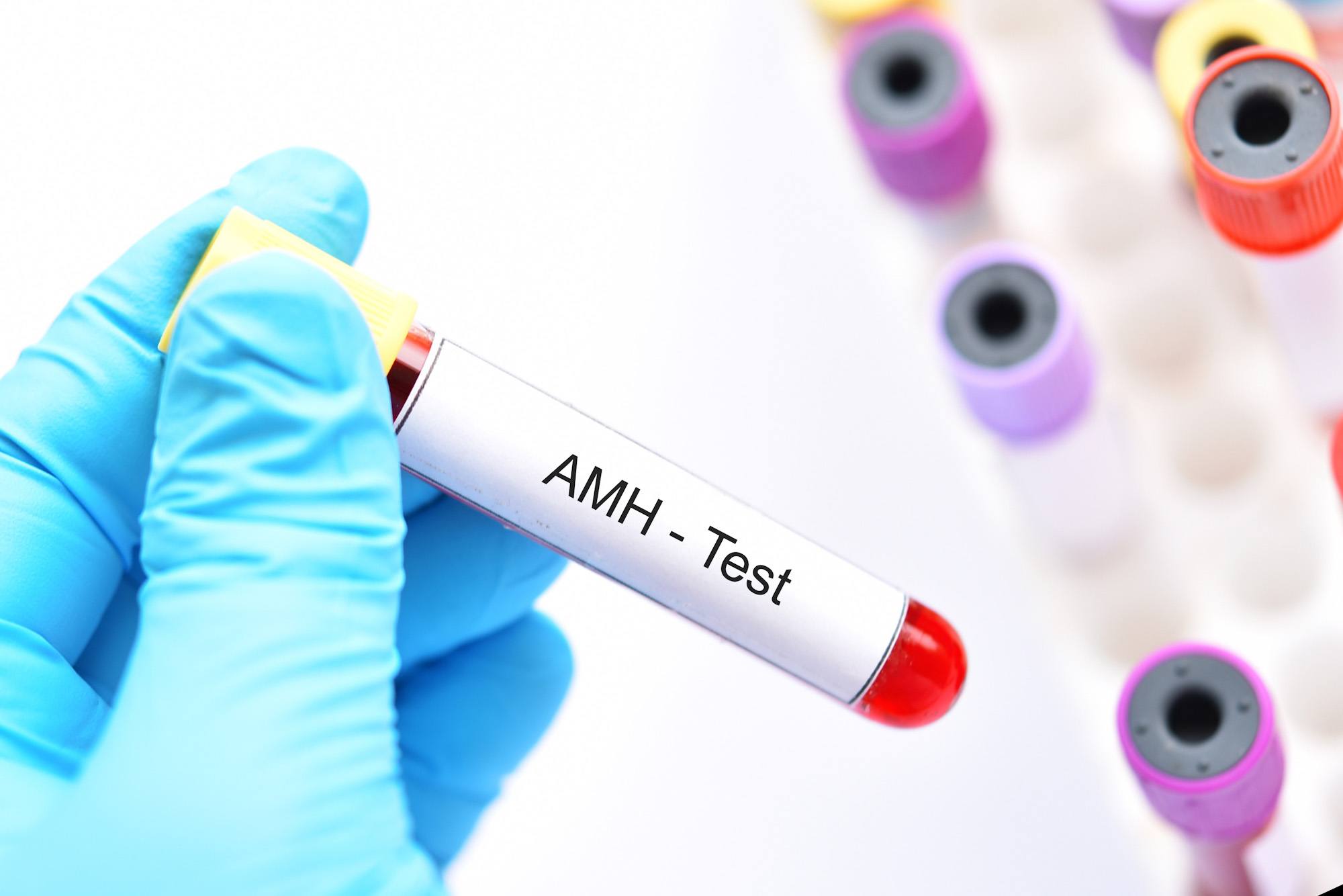 AMH test kit