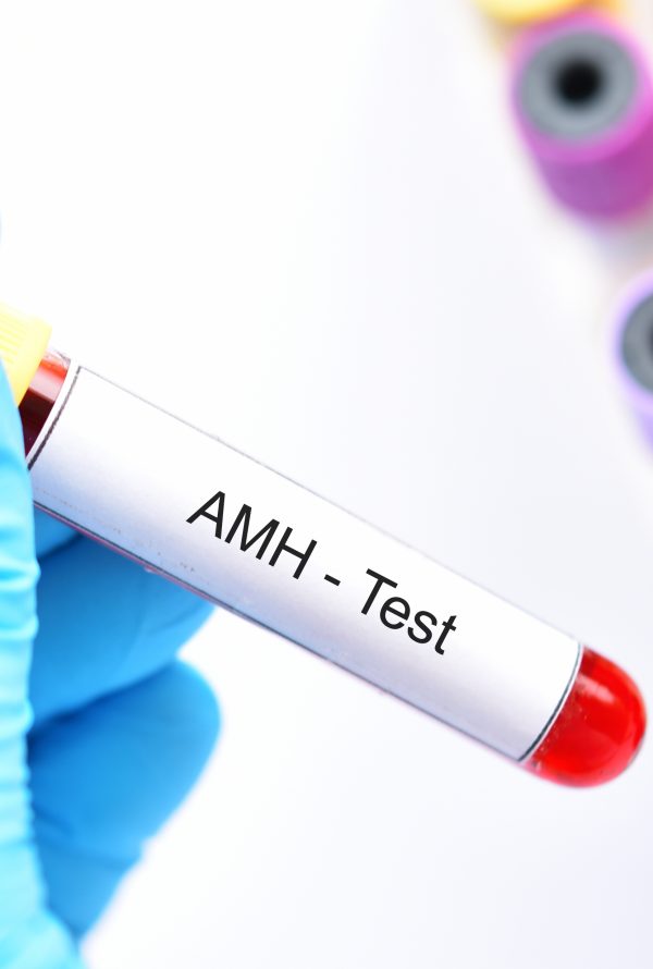 AMH Fertility